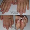 Nagelbijters