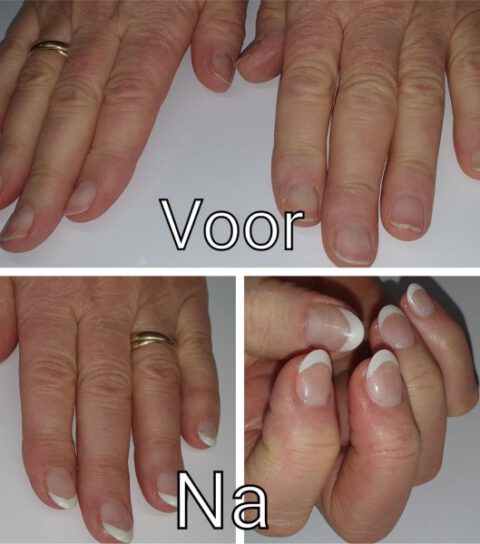 afbeelding nagelbijter